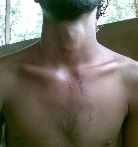 Camponês torturado por pistoleiros em Cujubim